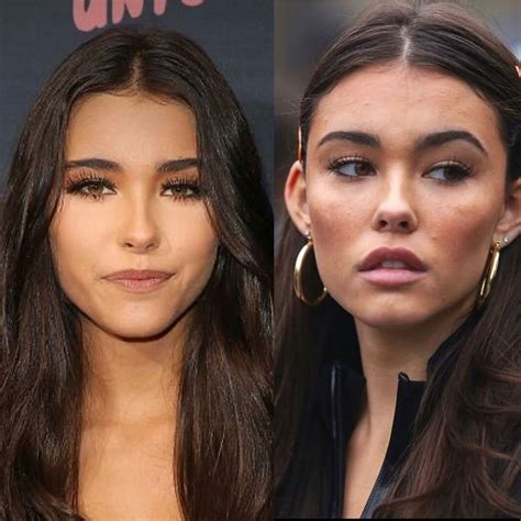 madison beer before plastic|Madison Beer Has Addressed Plastic Surgery Rumors。